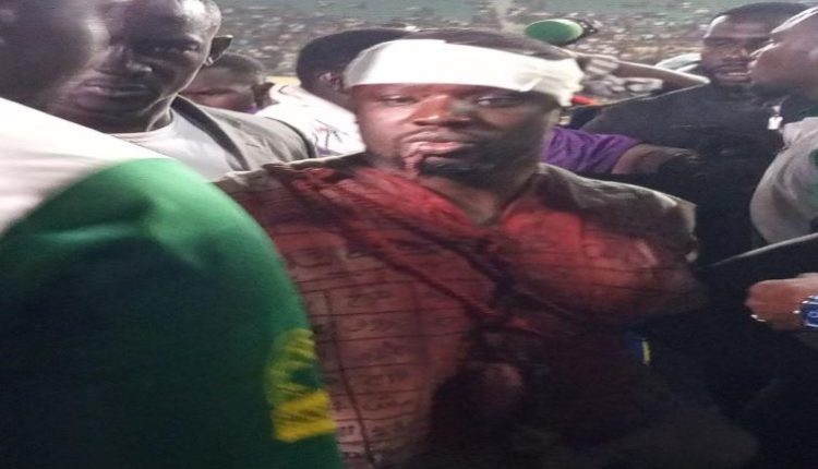 Papa Sow blessé à la tête avant d’affronter son adversaire Siteu