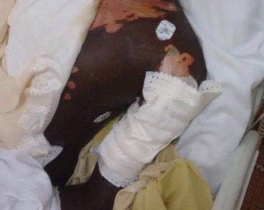 Une fille ébouillante son ex petit ami