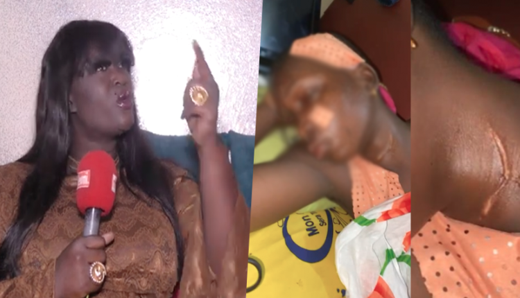 Sa petite soeur lacérée au visage : Gandé Guédiawaye fait de graves révélations