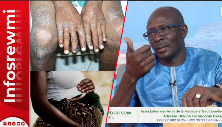 Ndokhoum siti, Djiguene bou beugue am dome : les graves révélations de Docteur Seydou Sow